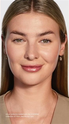 Natural-Looking Lip Plump for Summer with Juvederm®