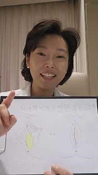 소음순성형 수술시 처녀막비대가 동반되어 있는 환자 사례