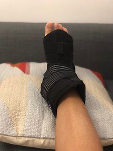 I Slept in This Plantar Fasciitis Splint for 2 Weeks and It Completely Cured My Foot Pain