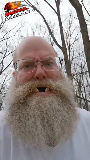 78K views · 346 reactions | #AbnormalHumans | ABNORMAL HUMANSᴵⁿˢᵃⁿᵉᴮʳᵃⁱⁿ | Facebook