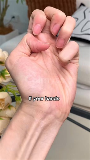 🙅‍♀️ That stiffness in your hands isn't "just nothing" — and ignoring it could make it worse. That morning stiffness that takes forever to fade. The dull ache that never really goes away. The swelling in your fingers that's getting harder to hide. 😖 These aren't just "normal aging" — they could be early warning signs of rheumatoid arthritis. And here's what most people don't realize: ignoring them now can make everything worse later. The stiffness gets tighter. The pain spreads. Simple tasks b