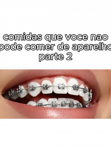 Comidas que você não pode comer com aparelho dentário