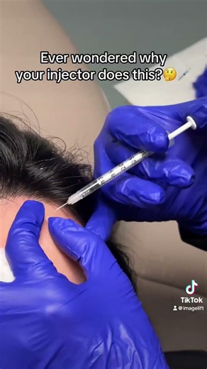 Ever notice a little shake or wiggle when your injector is placing tox?👀🫨