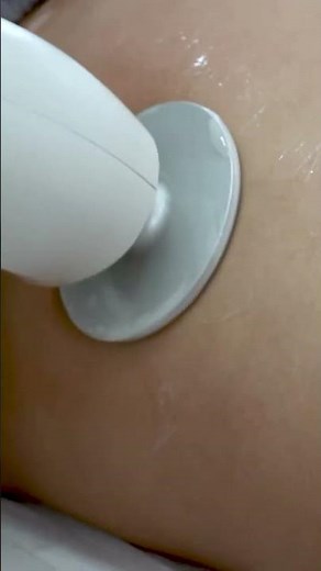 Alma Accent Prime Body 🤍