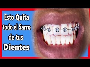 This Removes Tartar from Your Teeth and Whitens Them Naturally | Dental Care Tips