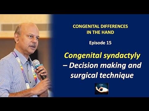 Congenital hand Episode 15: Congenital syndactyly: Decision making and surgical technique