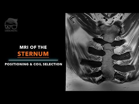 MRI OF THE STERNUM | POSITIONING & COIL SELECTION