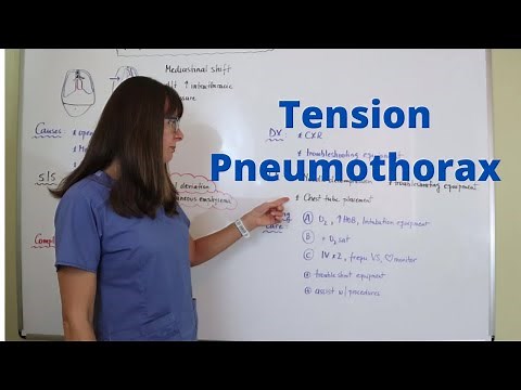 Tension Pneumothorax #emergencyresponse #nursing