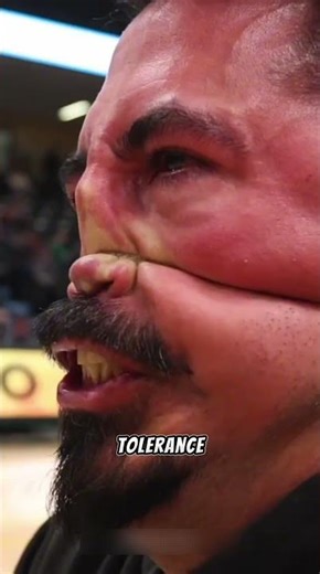 Extreme Pain Tolerance Challenge #shorts #painchallenges #extremesports