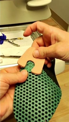 Relieving Pressure: Painful Callus Feels Like Walking on Gravel