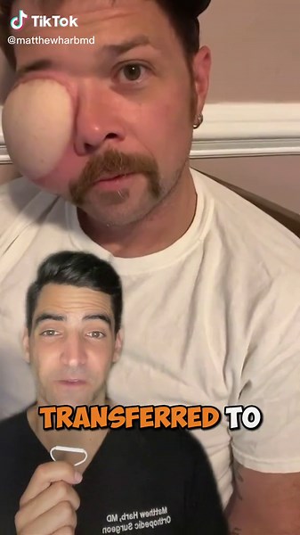 Understanding Skin Flap Surgery: Transfer Process Explained