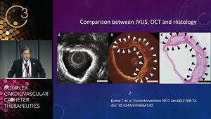 Optical Coherence Tomography is the Best Imaging Modality for a Calcified Lesion: How to Use It
