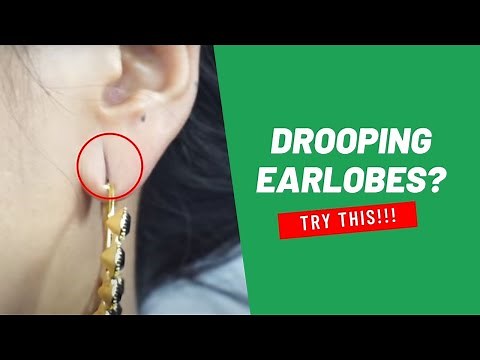 How to Shrink Drooping Earlobes Naturally - 5 Easy & Effective Home Remedies!
