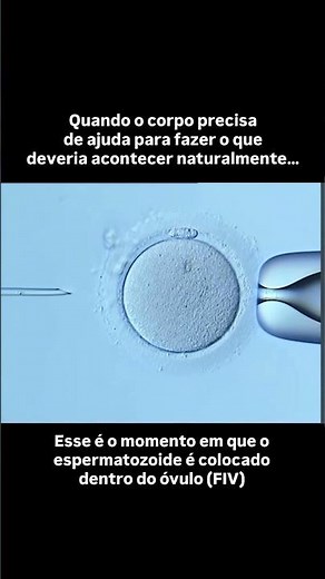 Fertilização in vitro - momento em que o espermatozoide é colocado dentro do óvulo