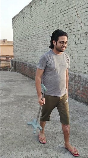 tibia surgery recovery after 240 days #tibia