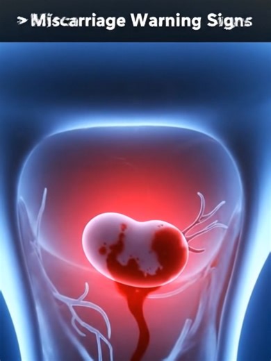 Understanding Miscarriage Signs During Pregnancy