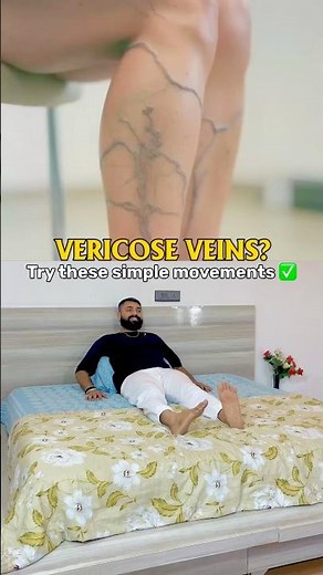 Varicose Veins Relief in 30 Seconds | Fix Leg Pain & Improve Blood Flow