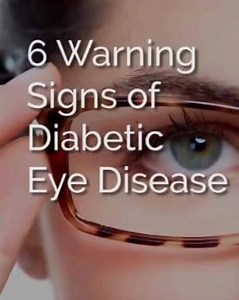 99K views · 789 reactions | Eye disease is a serious problem… And most people don’t even realise when they have it! | Manna Health | Facebook