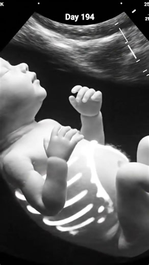 Pregnancy Week 27 (Day 194) | Ultrasound View 👶 #shorts #viralvideo