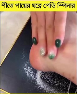 Callus Remover Machine : Vacuum Cleaner, Electronic Foot File Callus Remover Uses The Built In Vacuum Cleaner To Absorb Dead Skin. Power supply: USB Plug-In Or 4 x AAA Dry Batteries • Small And Portable • Electronic Foot File Replacement Roller • Compact Structure • Easy To Carry When Traveling Or On Vacation • Rechargeable • Electric Callus Remover With Rechargeable Feet Electric Foot Callus Remover Machine 😱 ✨Link in comment✨ #amazonfinds #amazonmusthaves #fyp #amazongadgets #Amazon #amazonus