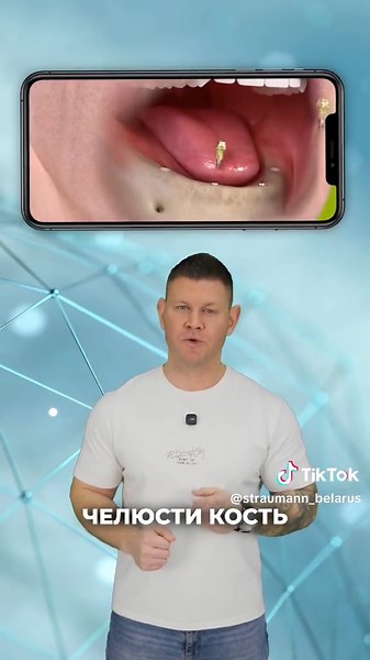 Имлантация зубов: стоит ли квартира?