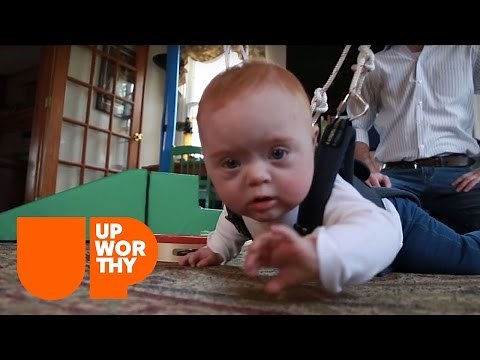 This Simple Harness Helps Down Syndrome Babies' Development!