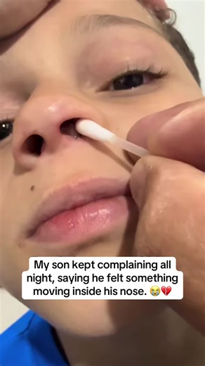 😭💔 #hospital #son #nose #mom #fyp | nose
