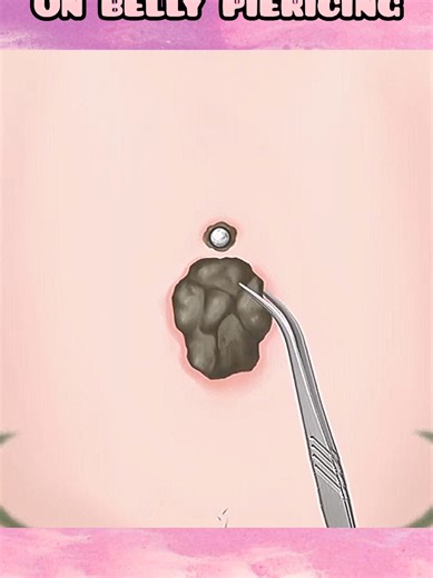 ASMR Belly Piercing Crust Removal | Deep Cleaning & Gentle Care Treatment #ASMR #BellyPiercing #DeepCleaning #PiercingCare #TikTokFYP