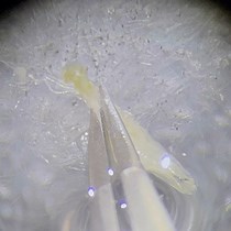 Long-term Imaging of Drosophila Neural Stem | JoVE Journal