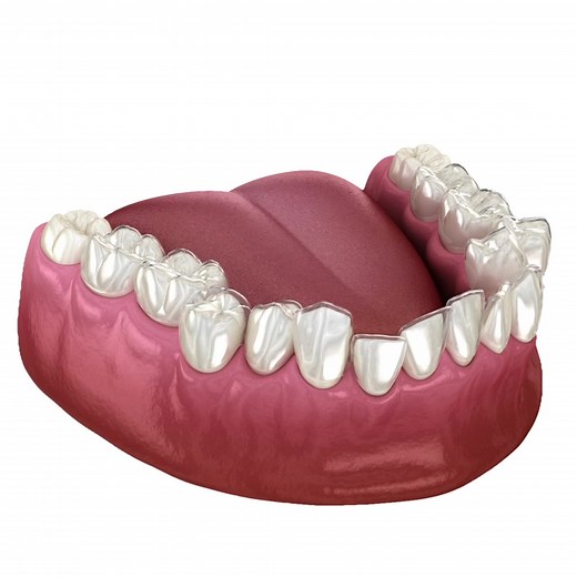 👋 Hey West London - There’s only 7 places left at our Invisalign open day on 29th November where you can save £1834 😲 Last Chance to Get our Invisalign offer which includes £1834 in discounts & savings! Here's the deal before the new price hike ✅ Get a Free Consultation & 3D Smile Scan worth £175 ✅ 20% OFF Post Treatment Composite Bonding 🎁 Free Teeth Whitening worth £450 🎁 Free Removable Retainers worth £500 🎁 Free Airflow worth £85 🎁 Free Dental Examination worth £45 🎁 Free Hygiene Appo