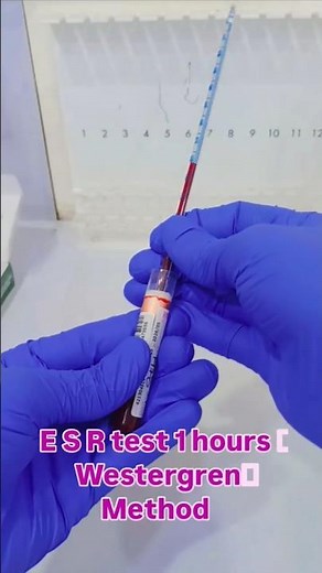 ESR test 1 hours westergren method #ESR #esrtests #bloodtest #pathology