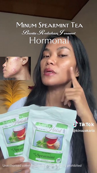 Manfaat Teh Spearmint untuk Mengatasi Jerawat Hormonal