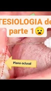 ANESTESIOLOGIA DENTAL🦷 PARTE 1🦷 Tecnicas de anestesia (anestesia troncular, intraseptal, etc)🦷