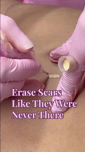 Mastering Scar Camouflage Techniques