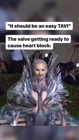 Dr. T. Burgers, FRCPC on Instagram: "I said we pacemaker dependent today . #cardiology #cardiologia #internalmedicine #cardiacsurgery #cvicu #medicalmemes #ccrn #criticalcare #icunurse #anesthesia #residency #medschool #medlife"