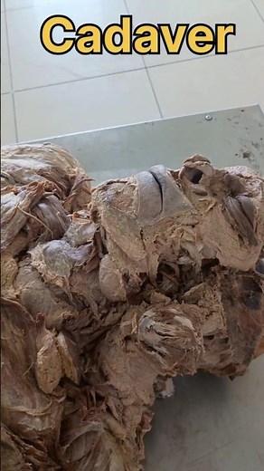 Cadaver - human anatomy 😞| #histopathology #anatomy #humanbody #histomuseum #anatomyfacts #histology