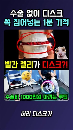 수술 없이 디스크 쏙 집어넣는 1분 기적