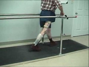 Stance Control with and without OM