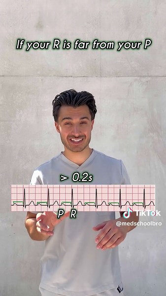 Understanding Heart Blocks: A Quick Guide