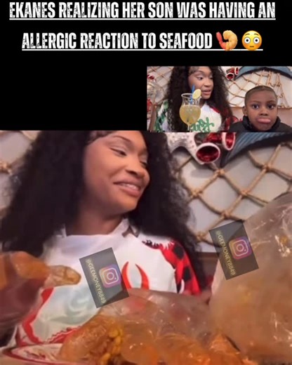 Gee Monet on Instagram: "ekanes realizing baby Chris was having an allergic reaction to seafood 🍤 😳 #ekane #ekaneandchris #trending #fyp #trendingreels #viralclips #ViralMoment #trendingnow"