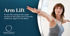 Arm Lift