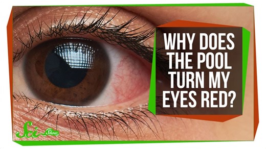Why do your eyes get red in the pool?