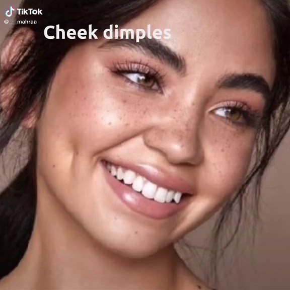Different Types of Cheek Dimples Explained