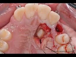 The Monsters Under Your Teeth, Bad Teeth In The World YouTube