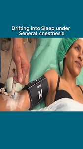 Drifting into sleep under general anesthesia #foryou #Dr_B #anesthesia #surgery #propofol | Inside Anesthesia