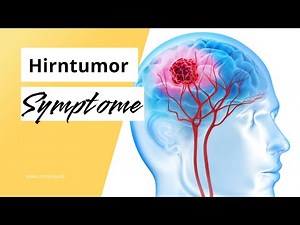 Hirntumor: Diese 6 Symptome sind möglich bei einer Hirngeschwulst