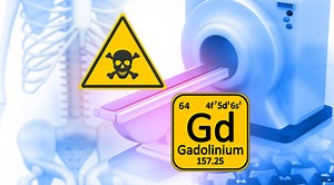Gadolinium Toxicity: The MRI Danger No One is Talking About