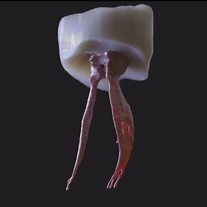 Pulpa dental 🦷 Síguenos en Instagram : https://www.instagram.com/smilecenterestetic/ | Smile center