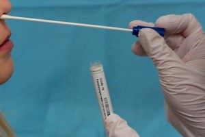 Teste de covid: as respostas às principais perguntas feitas no Google sobre PCR e antígeno