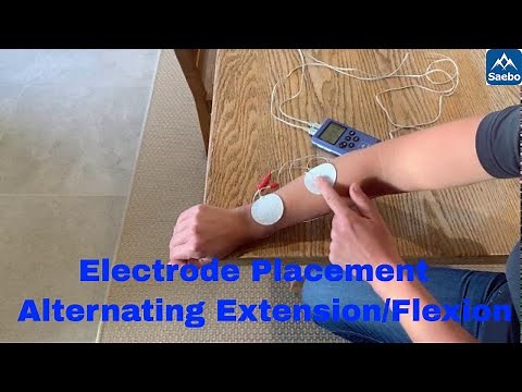 Electrode placement: alternating programme for wrist/finger extension and wrist/finger flexion